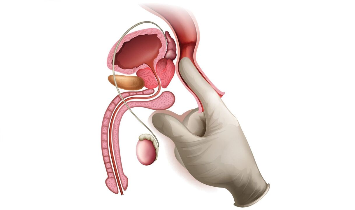 masaj de prostată pentru prostatită